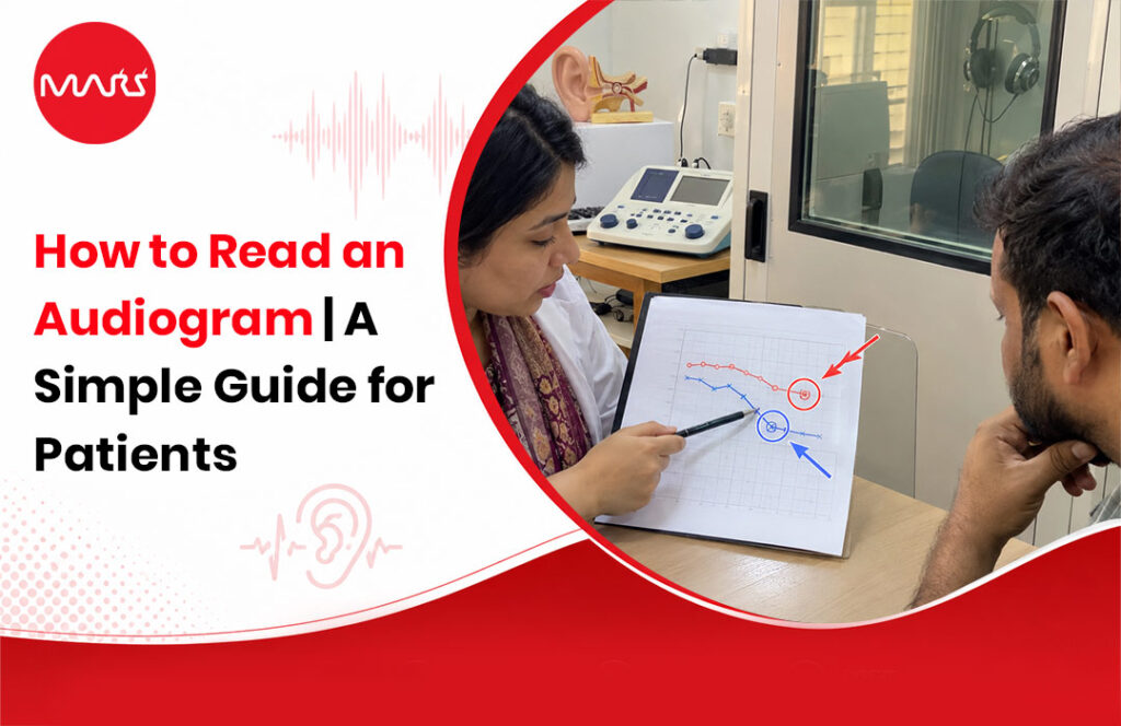 How to Read an Audiogram